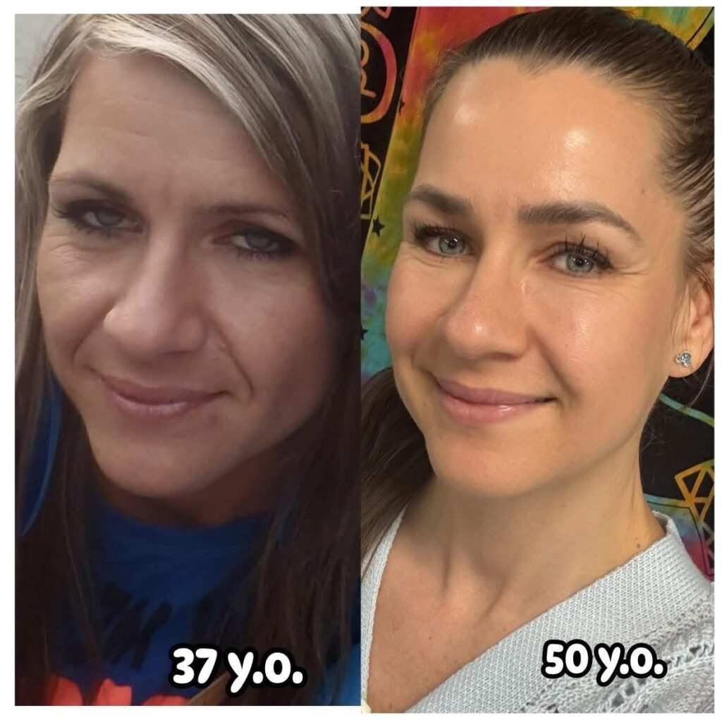 Ako môže face yoga zjemniť vrásky pod očami?